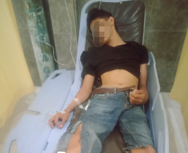 Beraksi di Way Jepara, Komplotan Pencuri Motor Dihajar Warga, Salah Satu Pelaku Babak Belur