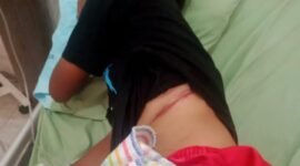 Vi, saat dibawa ke klinik setempat karena mengalami luka pada perut bagian samping kiri. Sumber: dok warga.